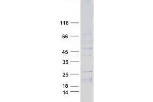 Validation with Western Blot (IL-15 Protein (Transcript Variant 1) (Myc-DYKDDDDK Tag))