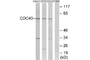 Western blot analysis of extracts from K562 cells, HUVEC cells and COLO cells, using CDC40 antibody. (CDC40 Antikörper  (Internal Region))