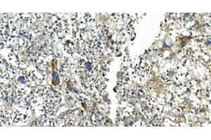 IHC analysis of CDC123 using anti-CDC123 antibody (ABIN7599284).