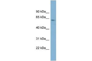 Western Blotting (WB) image for anti-Erythrocyte Membrane Protein Band 4.1 (Elliptocytosis 1, RH-Linked) (EPB41) (Middle Region) antibody (ABIN2775282)