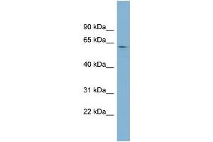 WB Suggested Anti-EPB41 Antibody Titration:  0. (EPB41 Antikörper  (Middle Region))