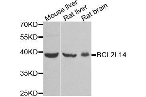 Western blot analysis of extracts of various tissues, using BCL2L14 antibody. (BCL2L14 Antikörper)