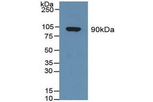 Figure. (Gelsolin Antikörper  (AA 674-782))