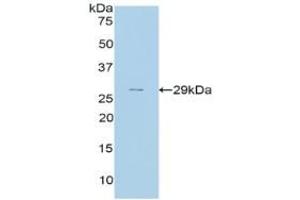 Detection of Recombinant CFH, Rat using Polyclonal Antibody to Complement Factor H (CFH)