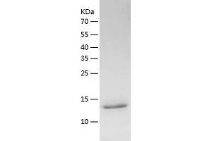 Western Blotting (WB) image for Interleukin 31 (IL31) (AA 24-163) protein (His tag) (ABIN7123589) (IL-31 Protein (AA 24-163) (His tag))