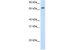 WB Suggested Anti-Mta2 Antibody Titration:  0. (MTA2 Antikörper  (N-Term))