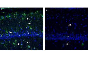 Expression of C5aR2 in rat hippocampus. (GPR77 Antikörper  (Extracellular))
