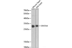 Western blot analysis of extracts of various cell lines using SPATA4 Polyclonal Antibody at dilution of 1:1000. (SPATA4 Antikörper)