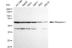 Western blotting analysis using Ribophorin I antibody (ABIN7800214). (Rekombinanter RPN1 Antikörper)