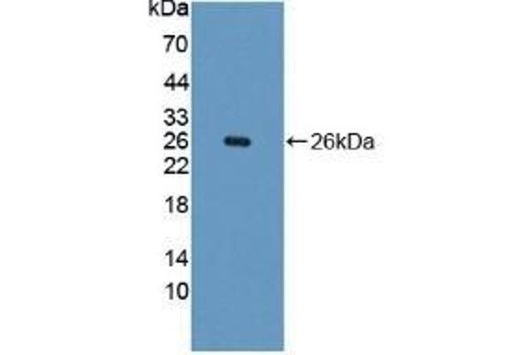 Phenylalanine Hydroxylase anticorps  (AA 228-452)