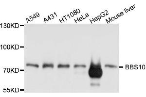 Western blot analysis of extract of various cells, using BBS10 antibody. (BBS10 Antikörper)