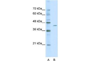 WB Suggested Anti-ZBTB26 Antibody Titration:  0. (ZBTB26 Antikörper  (Middle Region))