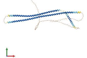Protein Structure (PS) image for Keratin 13 (KRT13) (AA 1-458) protein (His tag) (ABIN7548676)