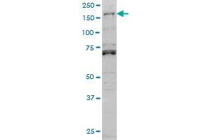 LMTK3 monoclonal antibody (M02A), clone 2H6 Western Blot analysis of LMTK3 expression in Hela S3 NE . (LMTK3 Antikörper  (AA 1151-1250))