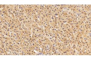 Immunohistochemistry (IHC) image for anti-S100 Calcium Binding Protein A6 (S100A6) (AA 1-90) antibody (ABIN7434041)