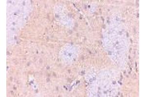 Immunohistochemistry of GPAT1 in rat brain with GPAT1 antibody at 2. (GPAM Antikörper  (C-Term))