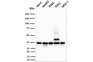 Western Blot Analysis of HeLa, HepG2, K562, A431 and MCF-7 cell lysate using RAD51 Mouse Monoclonal Antibody (RAD51/2701). (RAD51 Antikörper  (AA 1-134))