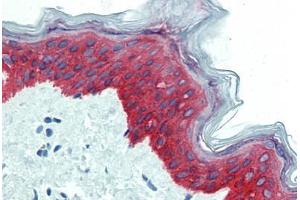 Skin, Human: Formalin-Fixed, Paraffin-Embedded (FFPE) (KRT14 Antikörper  (C-Term))