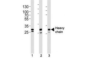 Western blot analysis of lysate from (1) A431, (2) MCF-7, (3) SK-BR-3 cell line using Cathepsin D antibody at 1:1000. (Cathepsin D Antikörper  (Heavy Chain))