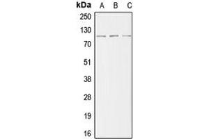 Western blot analysis of ACTN2 expression in HeLa (A), mouse kidney (B), H9C2 (C) whole cell lysates.