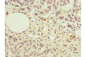 Immunohistochemistry (IHC) image for anti-Protein Phosphatase 2A 48 KDa Regulatory Subunit (PPP2R3B) (AA 356-575), (Regulatory Subunit B) antibody (ABIN7169283)