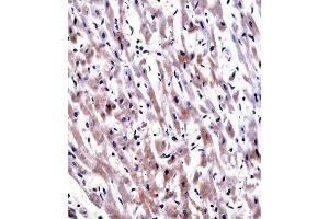 Immunohistochemistry (IHC) image for anti-Egl-9 Family Hypoxia Inducible Factor 3 (EGLN3) antibody (ABIN2997822) (EGLN3 Antikörper)