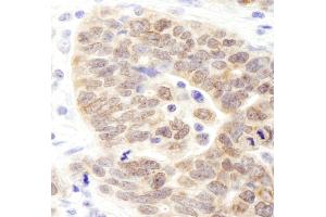 Immunohistochemistry (IHC) image for anti-Lysine (K)-Specific Demethylase 3B (KDM3B) (C-Term) antibody (ABIN7453716)