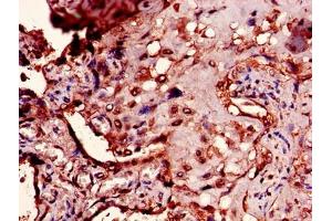 Immunohistochemistry of paraffin-embedded human placenta tissue using ABIN7166476 at dilution of 1:100 (PTMA Antikörper  (AA 5-110))