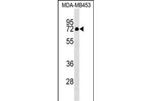 ZNF57 Antibody (N-term) (ABIN1539583 and ABIN2849296) western blot analysis in MDA-M cell line lysates (35 μg/lane). (ZFP57 Antikörper  (N-Term))