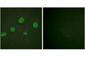 Immunofluorescence analysis of HuvEc cells, using GATA3 (Phospho-Ser308) Antibody. (GATA3 Antikörper  (pSer308))