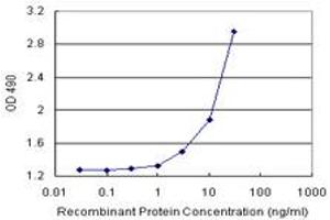 AMBP (Human) Matched Antibody Pair