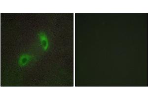 Immunofluorescence analysis of HUVEC cells, using HGS antibody. (HGS Antikörper)