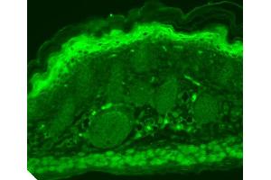 Immunohistochemistry analysis using Mouse Anti-TrpV3 Monoclonal Antibody, Clone S15-4 . (TRPV3 Antikörper  (AA 774-791) (PerCP))