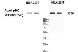 Western Blot (WB) analysis of HeLa 293T using EP300 antibody. (p300 Antikörper)