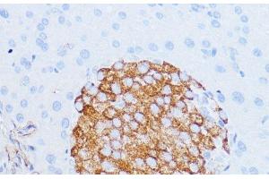 Immunohistochemistry of paraffin-embedded Mouse pancreas using NOTCH3 Polyclonal Antibody at dilution of 1:100 (40x lens). (NOTCH3 Antikörper)