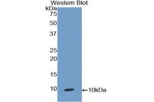 Western blot analysis of the recombinant protein. (CCL19 Antikörper  (AA 32-103))