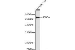 Western blot analysis of extracts of Mouse lung using SCN5A Polyclonal Antibody at dilution of 1:1000. (SCN5A Antikörper)
