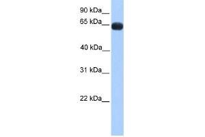 WB Suggested Anti-ZNF100 Antibody Titration:  0. (ZNF100 Antikörper  (N-Term))