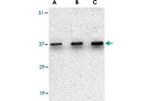 Western blot analysis of UNG in C2C12 cell lysate with UNG polyclonal antibody  at (A) 0. (UNG Antikörper  (C-Term))