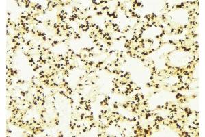 ABIN6278679 at 1/100 staining Mouse lung tissue by IHC-P. (CDKL5 Antikörper  (Internal Region))