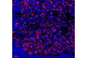 Immunofluorescence of paraffin embedded mouse lymph node using SLBP (ABIN7075733) at dilution of 1: 650 (400x lens) (SLBP Antikörper)