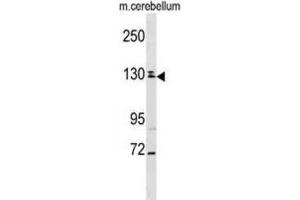 Western Blotting (WB) image for anti-TBC1 Domain Family, Member 8 (With GRAM Domain) (TBC1D8) antibody (ABIN2999068) (TBC1D8 Antikörper)