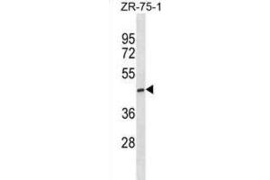 Western Blotting (WB) image for anti-ST6 (Alpha-N-Acetyl-Neuraminyl-2,3-beta-Galactosyl-1,3)-N-Acetylgalactosaminide alpha-2,6-Sialyltransferase 5 (ST6GALNAC5) antibody (ABIN3000960) (ST6GALNAC5 Antikörper)