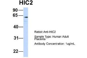 Host:  Rabbit  Target Name:  HIC2  Sample Type:  Human Adult Placenta  Antibody Dilution:  1.