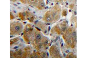 IHC-P analysis of Liver tissue, with DAB staining. (Fibrinogen beta Chain Antikörper  (AA 45-491))