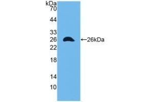 Detection of Recombinant CX43, Mouse using Polyclonal Antibody to Connexin 43 (CX43) (Connexin 43/GJA1 Antikörper  (AA 180-382))