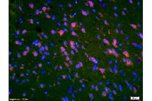 Formalin-fixed and paraffin-embedded rat brain labeled with Anti-PMP2 Polyclonal Antibody, Unconjugated (ABIN676823) 1:200, overnight at 4°C, The secondary antibody was Goat Anti-Rabbit IgG, Cy3 conjugated used at 1:200 dilution for 40 minutes at 37°C. (PMP2 Antikörper  (AA 31-132))
