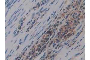 DAB staining on IHC-P;;Samples: Human Lung Tissue