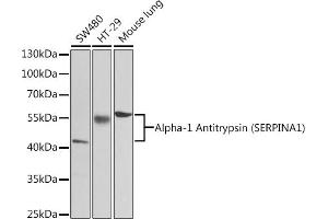 Western blot analysis of extracts of various cell lines, using Alpha-1 Antitrypsin (Alpha-1 Antitrypsin (SERPIN)) antibody (2481) at 1:1000 dilution. (SERPINA1 Antikörper  (AA 25-315))