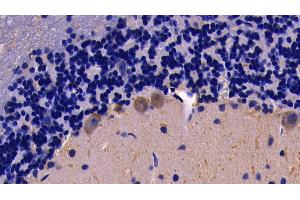 Detection of TNFa in Rat Cerebellum Tissue using Polyclonal Antibody to Tumor Necrosis Factor Alpha (TNFa) (TNF alpha Antikörper  (AA 80-235))